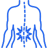 Sciatica